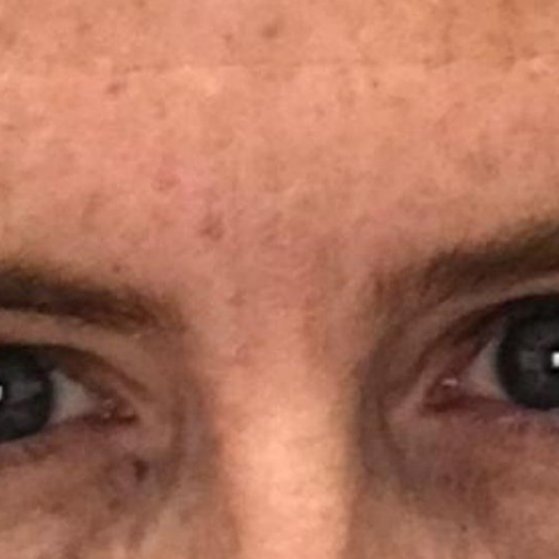 Wrinkle Relaxers After