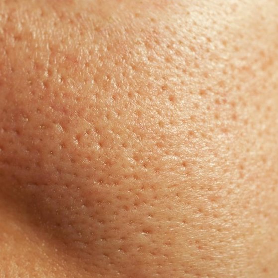 Large Pores