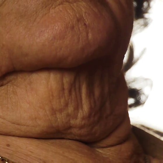 Ageing Neck