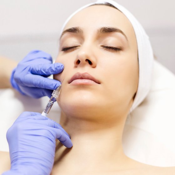 Dermal Fillers
